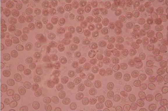 Processed blood indicating full fields of oocysts of E. zuernii 