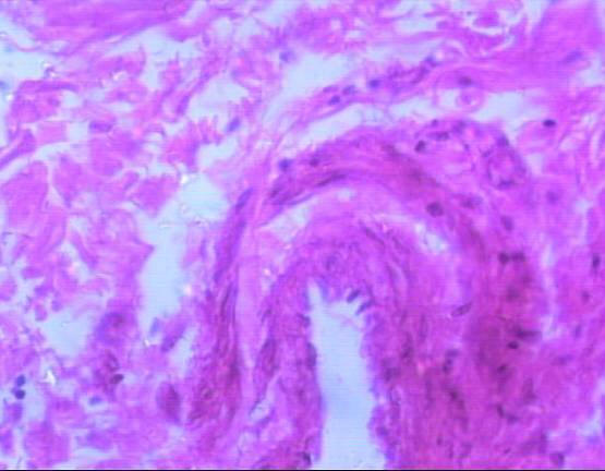 Inter-lobular ducts with pseudostratified lining epithelium, veins and arterioles