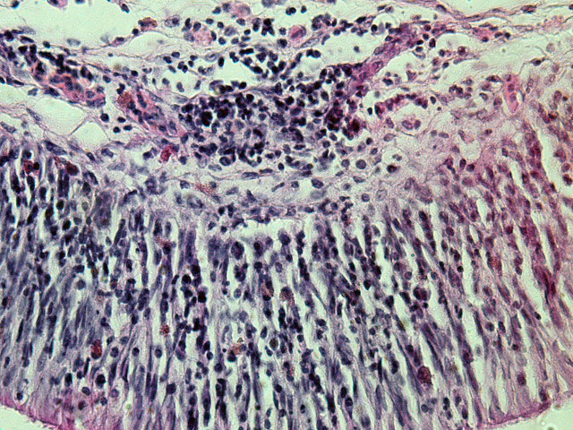 Fig. 7. The laminal propria of trachea.  Showing abundant lymphocyte and plasma cells. (PAS , 40X). 